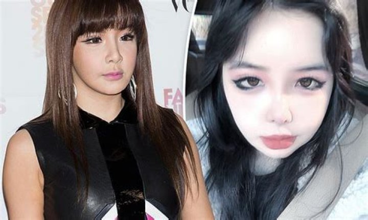 2ne1 Park Bom Before Surgery