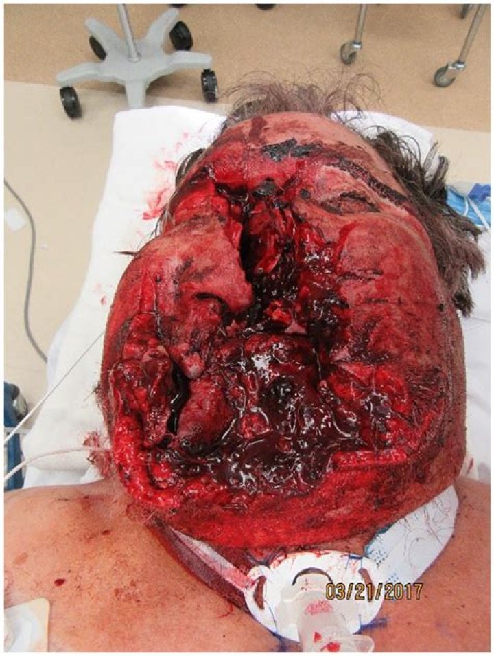 Autopsy Reveals Shocking Details Of Gunshot Wounds