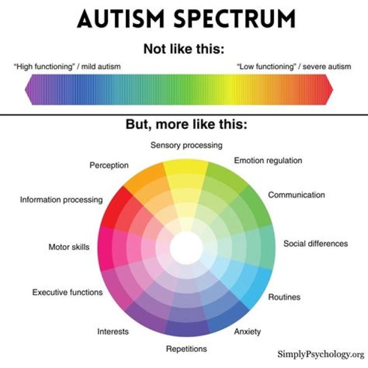 Could Prince Have Been On The Autism Spectrum?