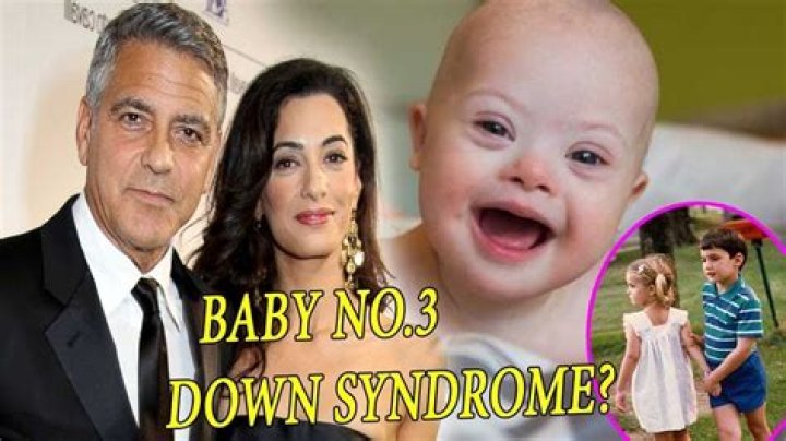 Is George Clooney's Child Living With Down Syndrome?
