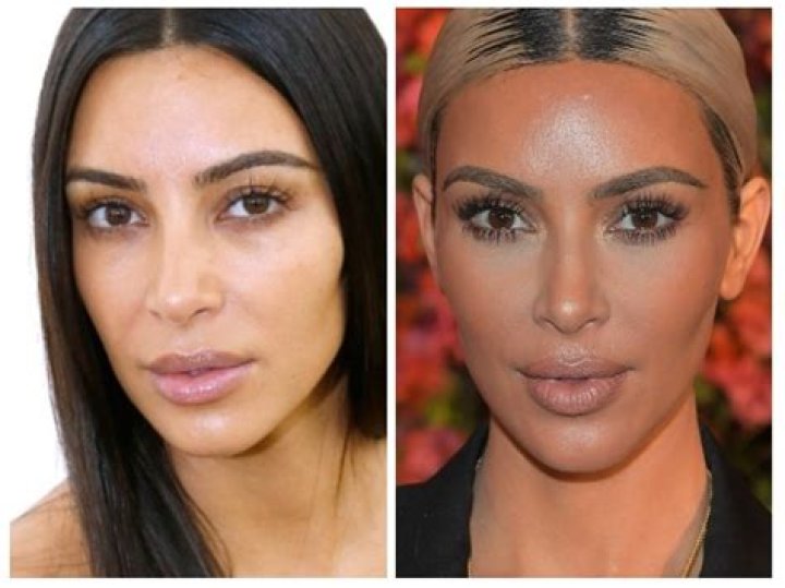 Kim K's Transformation: Before And After BBL