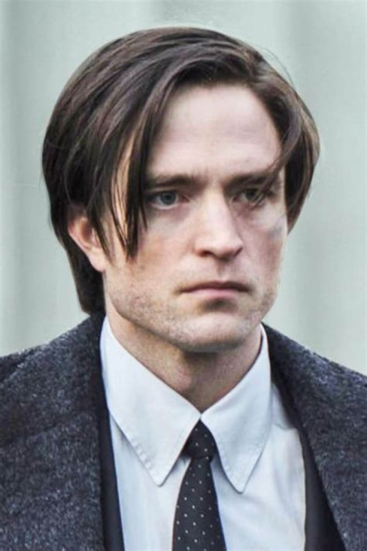 Robert Pattinson's Hairline: The Evolution Through The Years