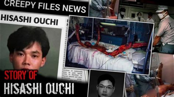 The Shocking Truth: Hisashi Ouchi's Real Body Photo Revealed