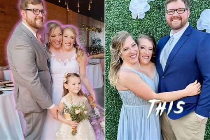 The Tragic Fate Of Abby And Brittany Hensel: A Family's Unforgettable Loss