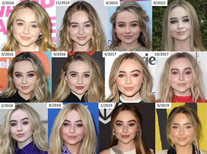 The Ultimate Guide To Sabrina Carpenter's Filler: Benefits, Risks, And Results