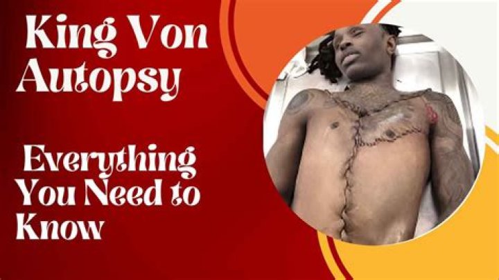 The Ultimate Guide To Von Autopsy Reports