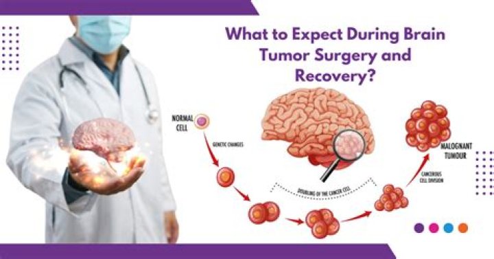 Unraveling Sheldon Bream's Brain Tumor: Discoveries And Insights